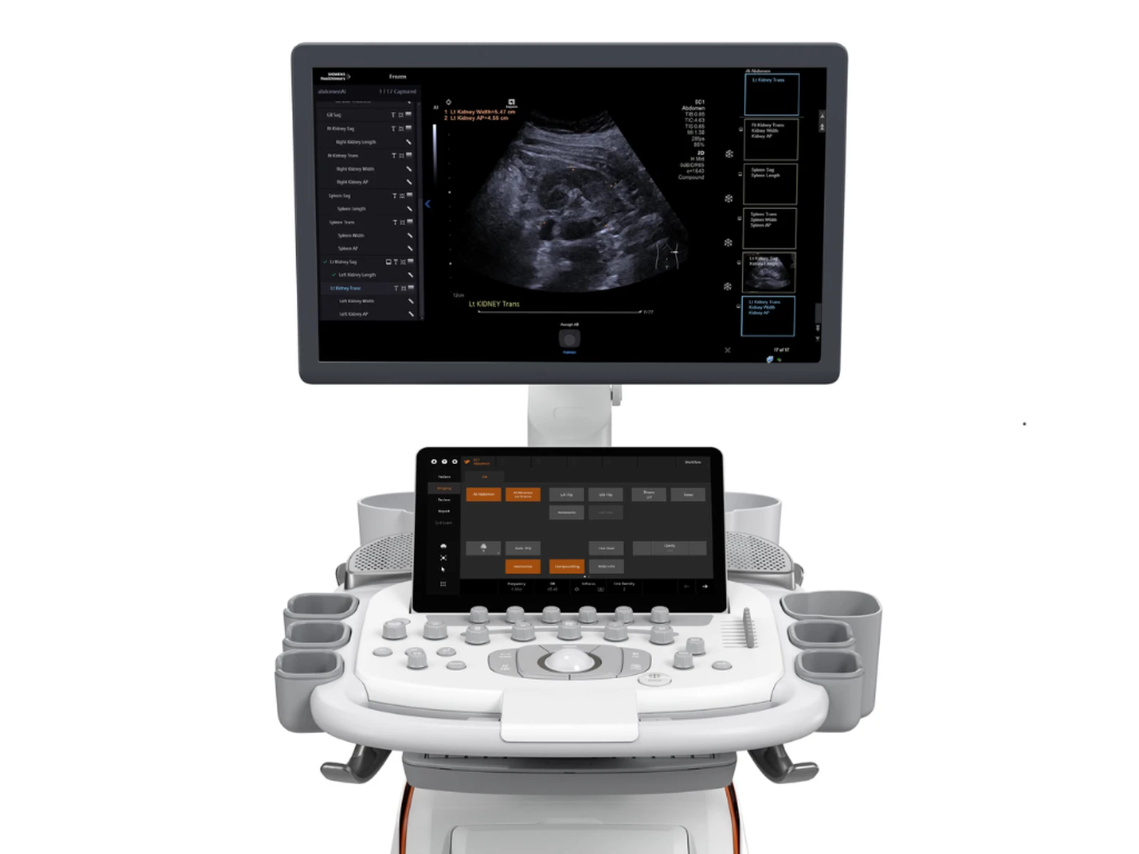 Siemens ACUSON Sequoia